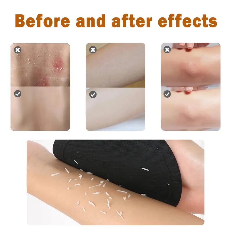 🚿💦4-Pack Soft Rubber Shower Scrubber for Gentle Exfoliation & Deep Cleansing