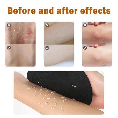 🚿💦4-Pack Soft Rubber Shower Scrubber for Gentle Exfoliation & Deep Cleansing