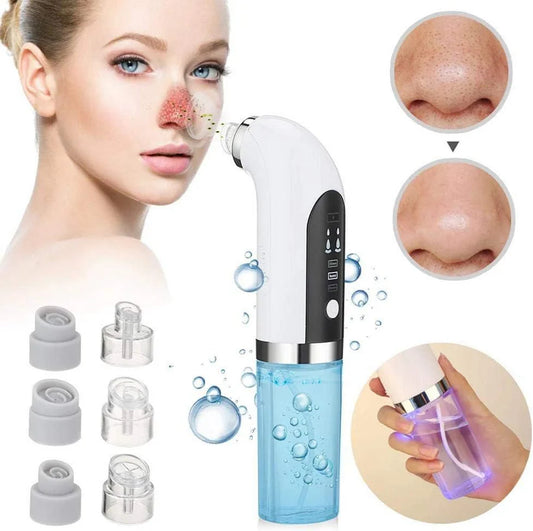 ⚡️FLASH SALE 50% OFF⚡️- Vacuum Blackhead Remover