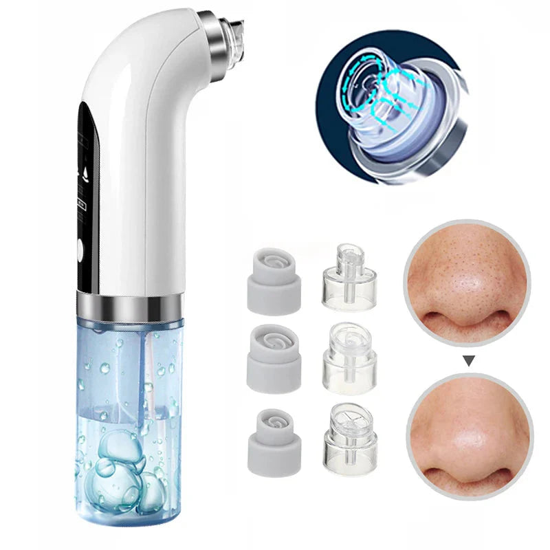 ⚡️FLASH SALE 50% OFF⚡️- Vacuum Blackhead Remover
