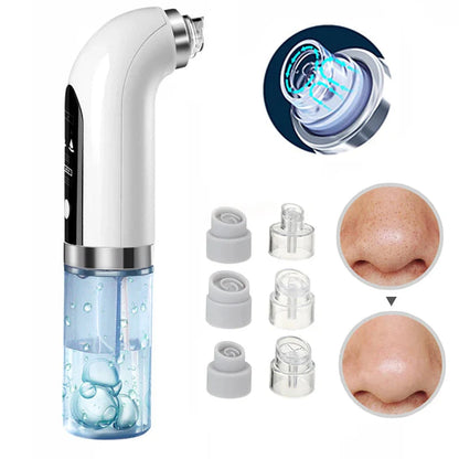 ⚡️FLASH SALE 50% OFF⚡️- Vacuum Blackhead Remover