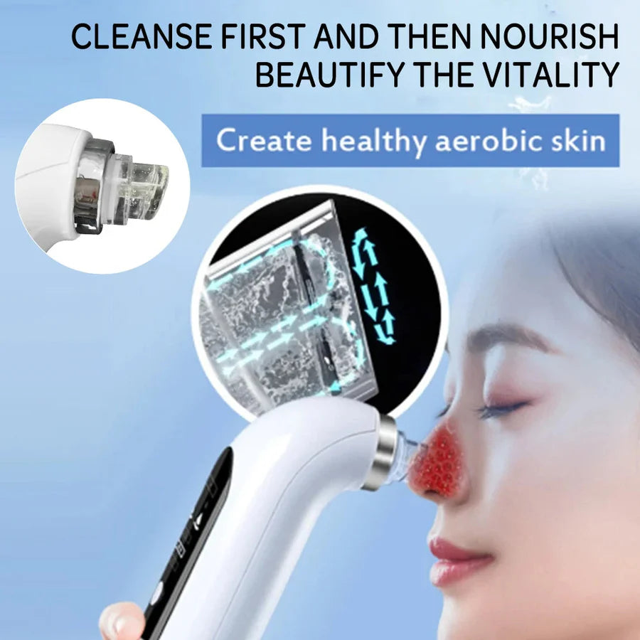 ⚡️FLASH SALE 50% OFF⚡️- Vacuum Blackhead Remover