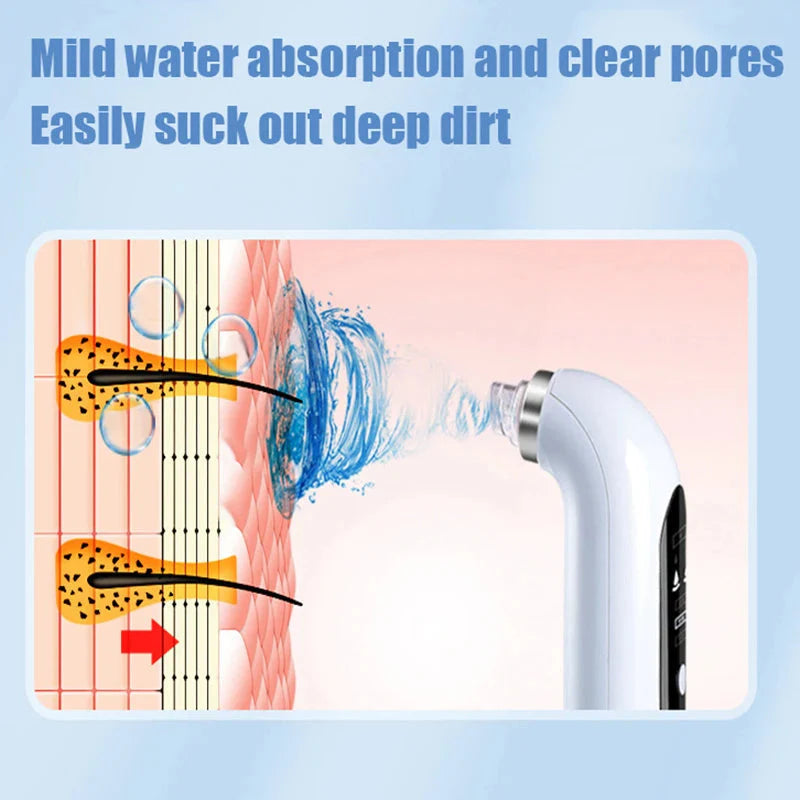 ⚡️FLASH SALE 50% OFF⚡️- Vacuum Blackhead Remover