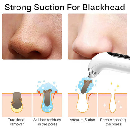 ⚡️FLASH SALE 50% OFF⚡️- Vacuum Blackhead Remover